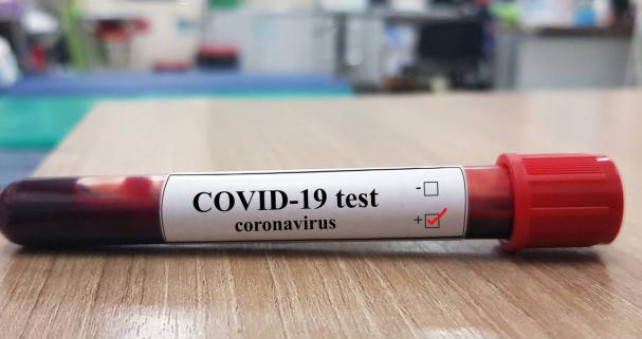    Udio pozitivnih na koronavirus i dalje pada, danas iznosi 10,4%