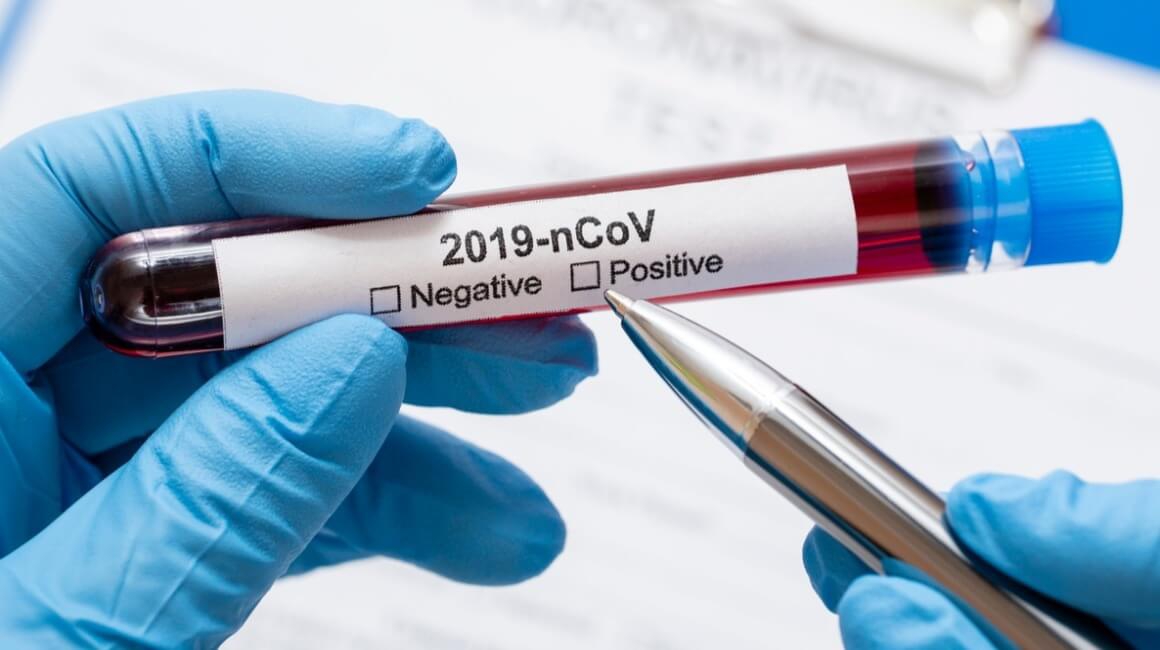 Pet pozitivnih na koronavirus u OBŽ
