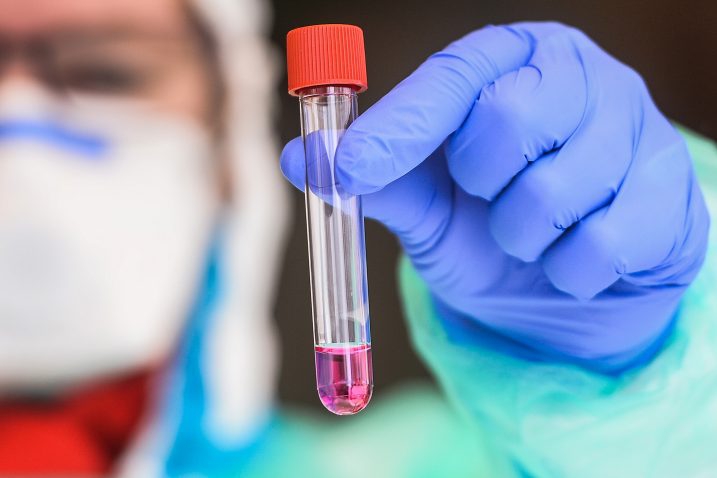 Na koronavirus 31 osoba novopozitivna, 6 osoba preminulo