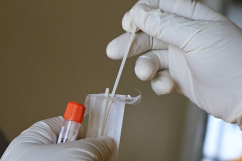 58 novopozitivnih na koronavirus u OBŽ   