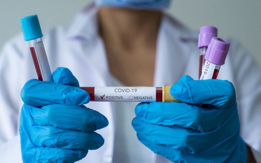 Osam novopozitivnih na koronavirus